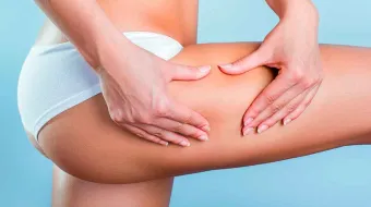 La forma del GLÚTEO mayor revela indicadores tempranos de DIABETES tipo 2, concluye amplio estudio 