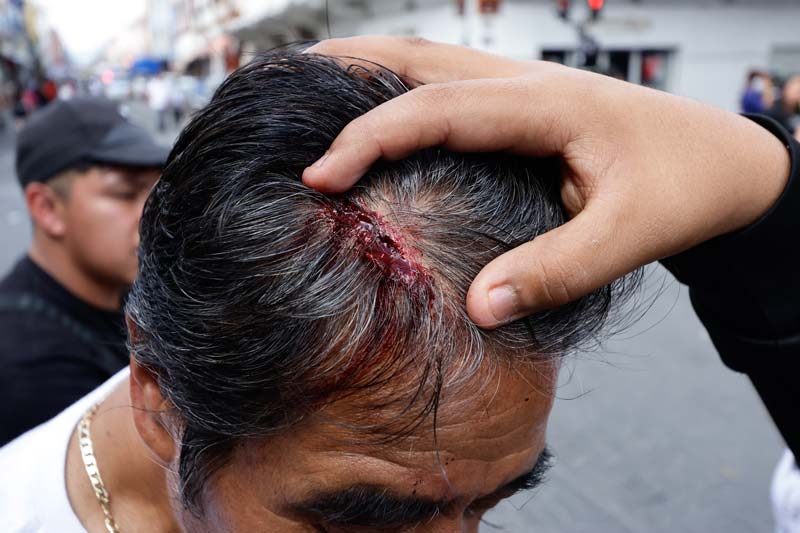13 personas heridas tras operativo contra comerciantes en el Centro Histórico de Puebla