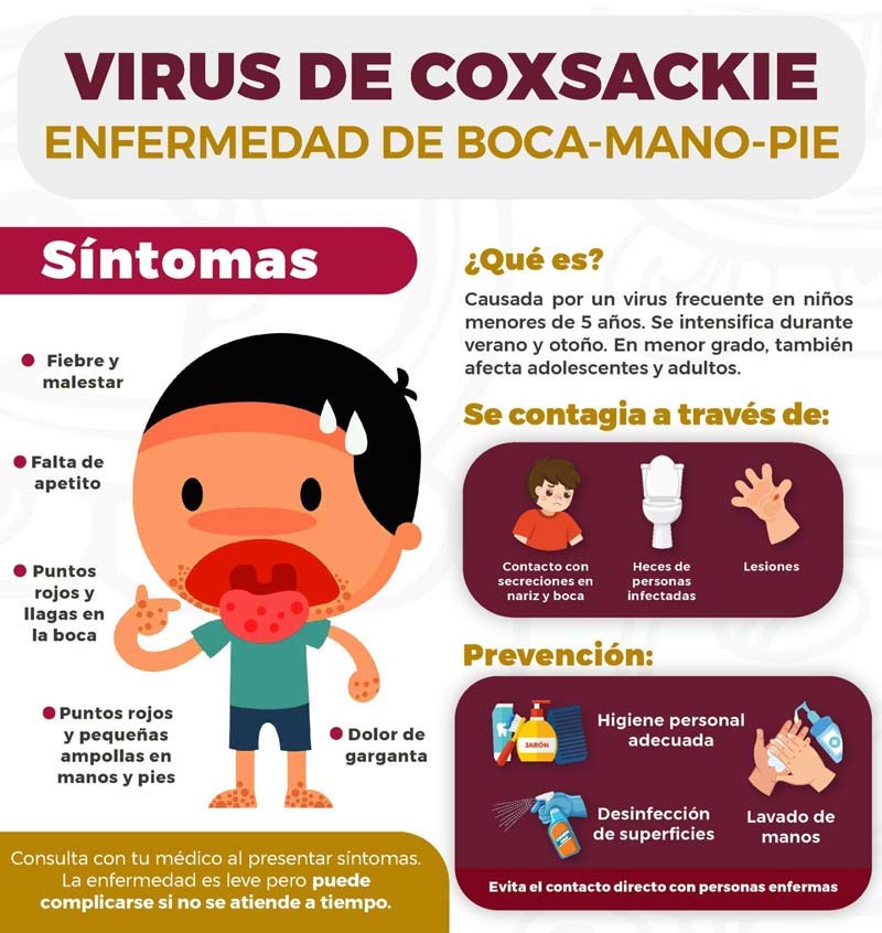 Escuelas de Puebla suspenden clases por brote de virus Coxsackie entre alumnos