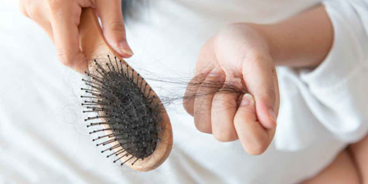 Alopecia en hombres