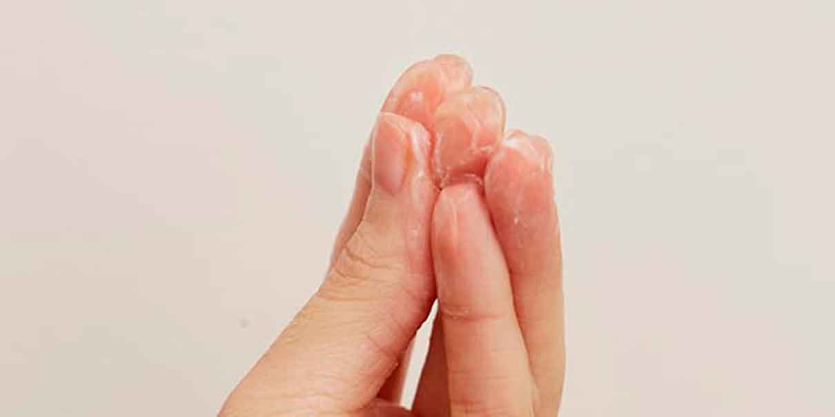 Flujo vaginal