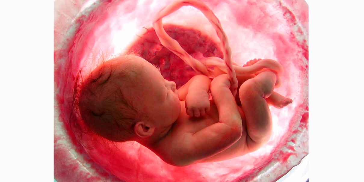 Maternidad