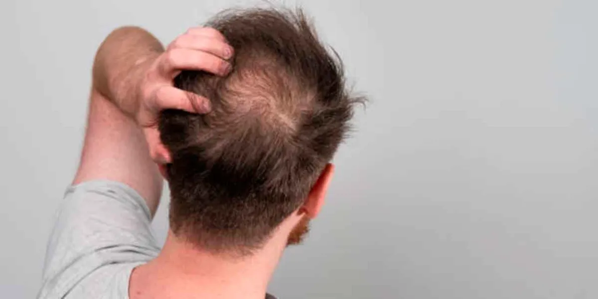 5 consejos infalibles para frenar la caída del pelo en hombres y mantenerlo fuerte