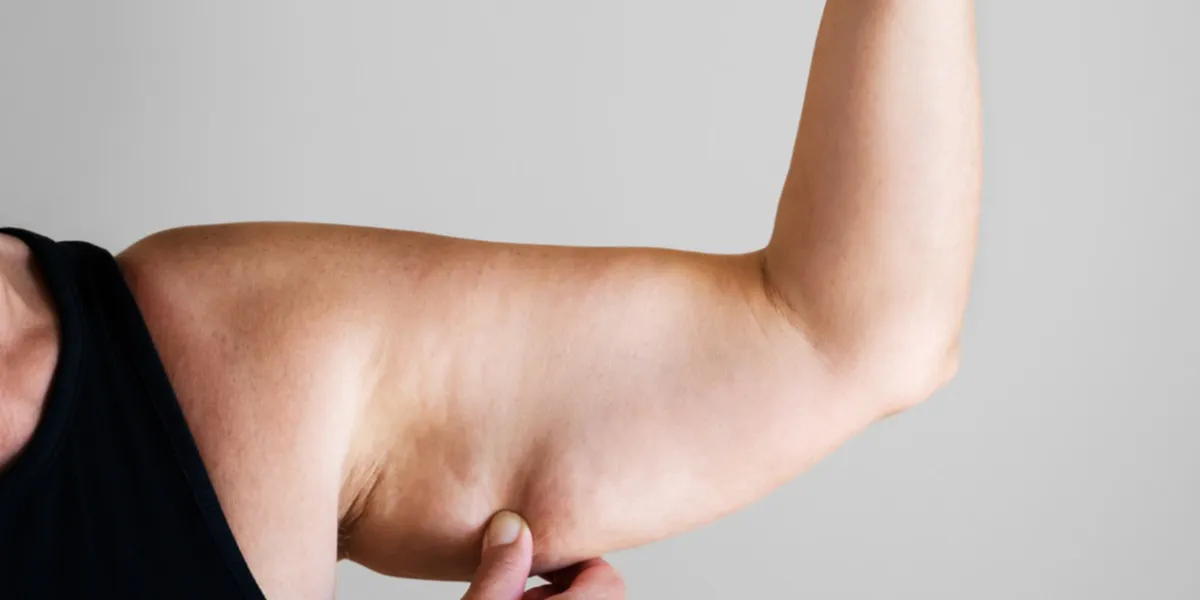 Grasa en los brazos: causas hormonales, genéticas y estrategias efectivas para reducirla