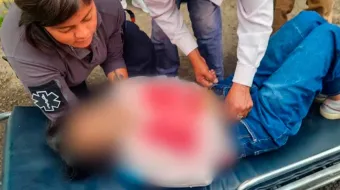 Mujer de Texmelucan fue apuñalada por su expareja 