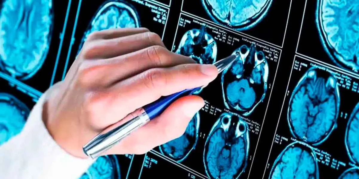 Fastball: la prueba rápida que detecta riesgo de Alzheimer en solo tres minutos
