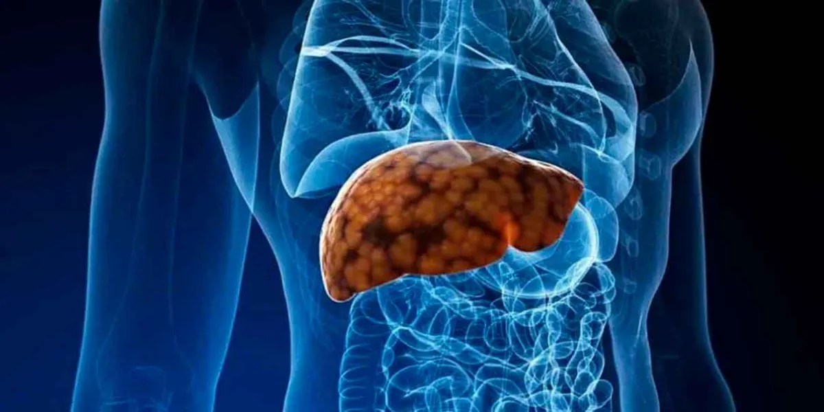 Nutrientes esenciales para revertir el HÍGADO GRASO y mejorar la salud metabólica